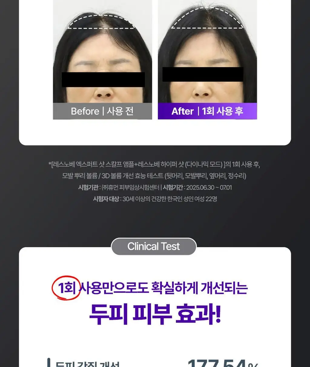 [No.1 헤어/두피 디바이스] 레스노베 하이퍼샷(베이지/핑크) 상세페이지 21